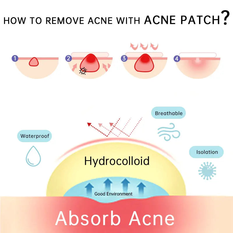 (BUY 1 GET 2) AUQUEST - Invisible Zit Patch